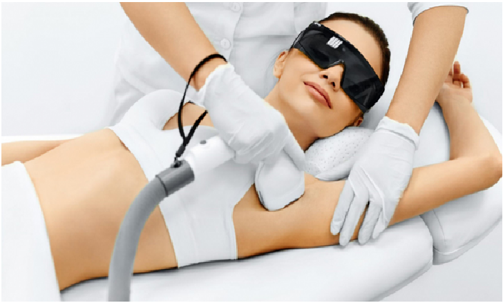 Laser Hair Removal