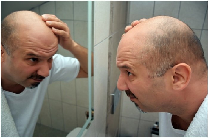 Hair Loss